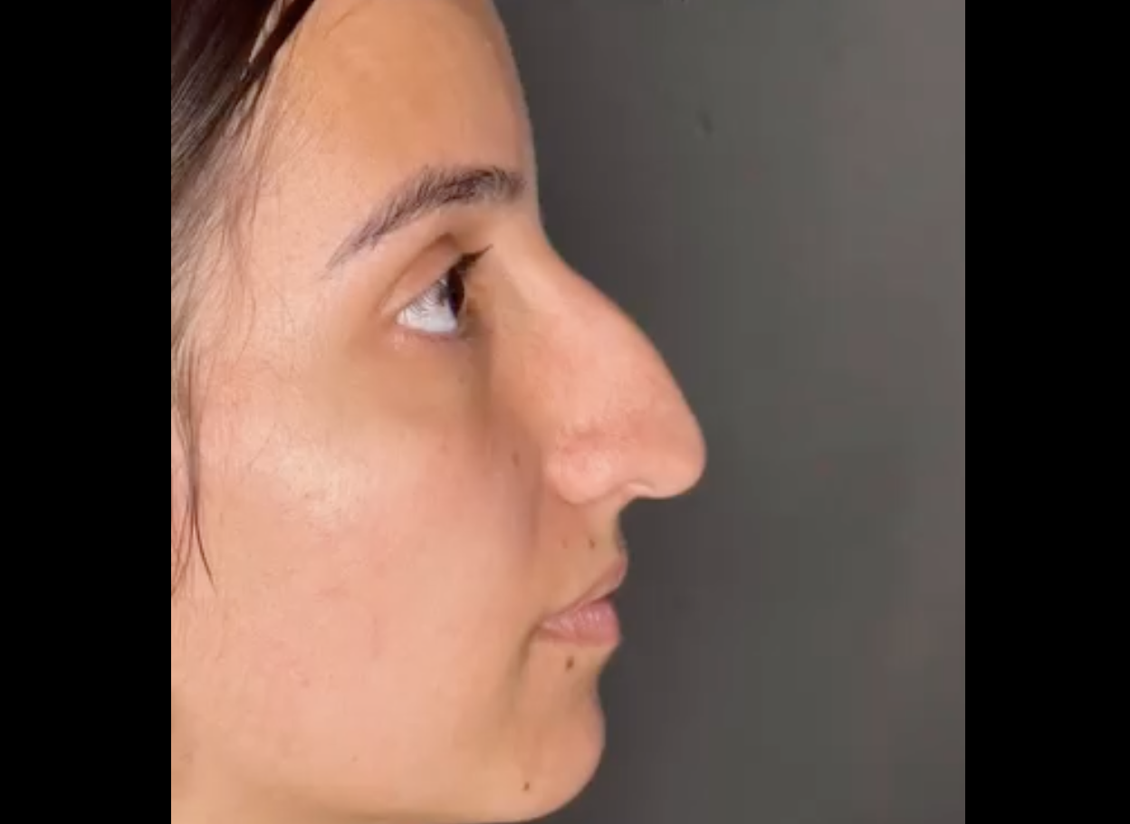 She Changed One Thing About Her Face—Now Everyone’s Talking About Her